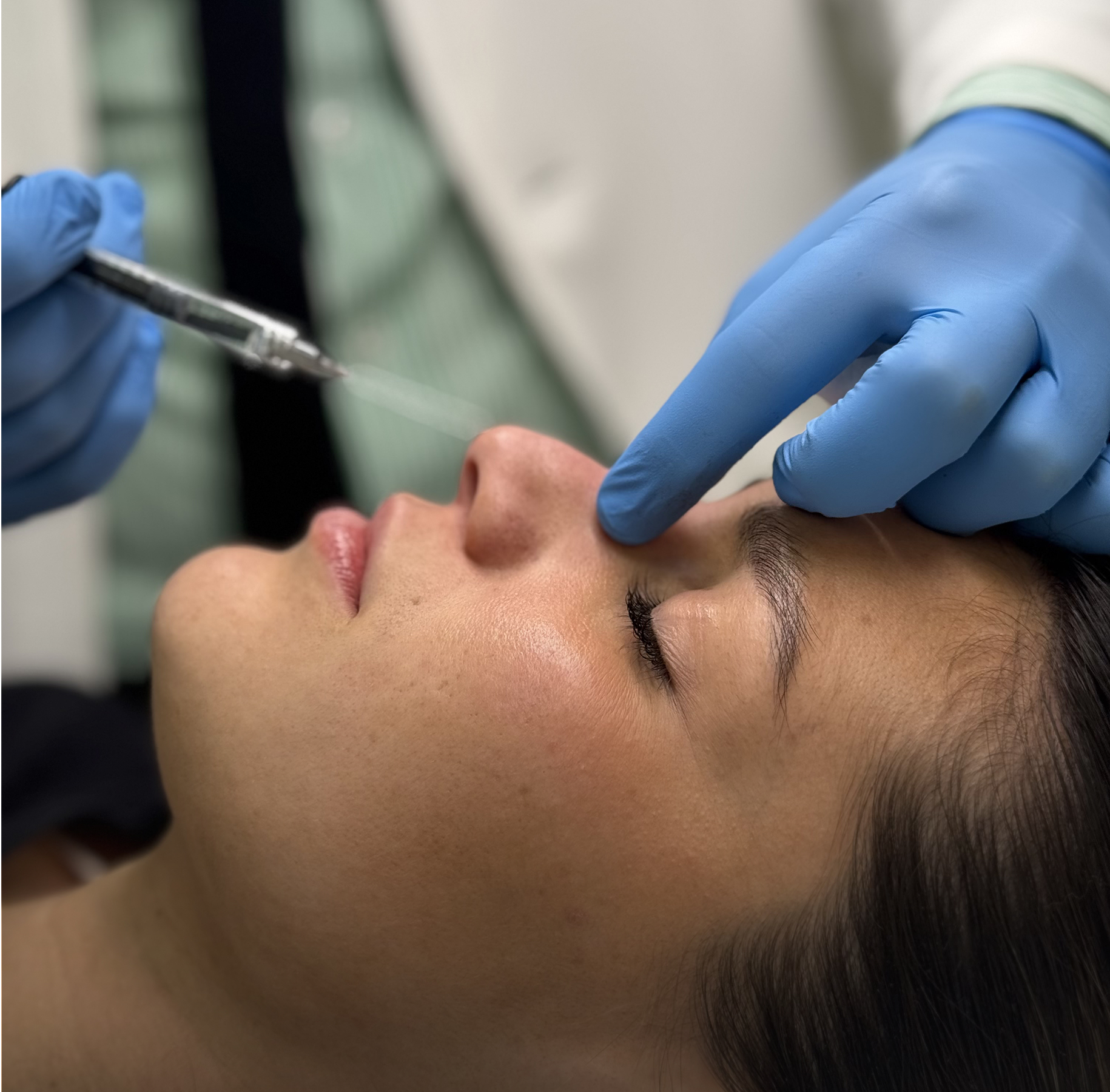 Tratamentos Faciales en Madrid